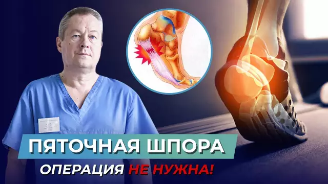 Распутывание короткой пяточной пятки: учебник по ремеслам