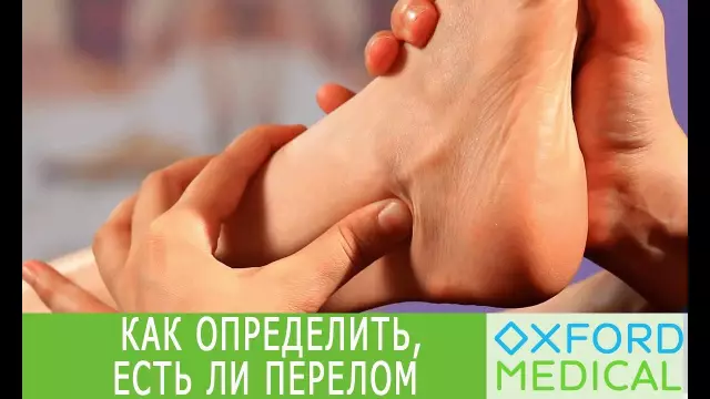 Как определить амортизацию ограды