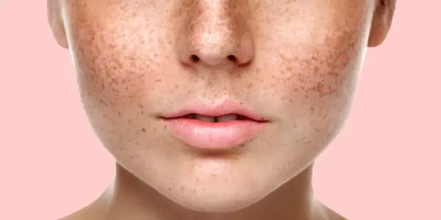 Как удалить мочу пятна из унитаза