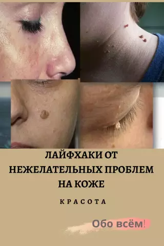 Как удалить пятна уксуса из мраморных поверхностей, таких как столешницы и полы