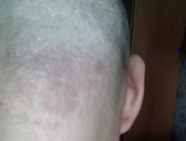 Что вызывает появление красных водорослей в плавательных бассейнах?