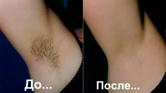Как удалить белые подмышки из темных рубашек