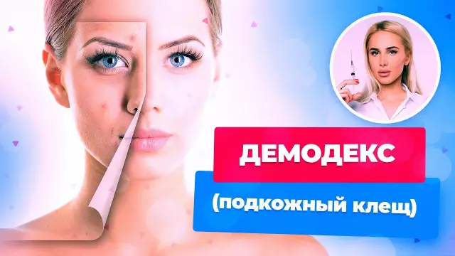 Как получить Demodex клещей из подушек