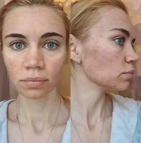 Сколько уксуса использовать для чистки кофеварки