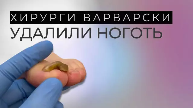 Как удалить отражательную пластину из деревянного нагревателя