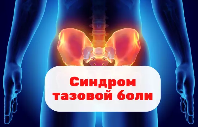 Что представляет собой мельницу?
