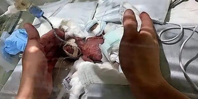 Сколько граммов весит флакон с таблетками?